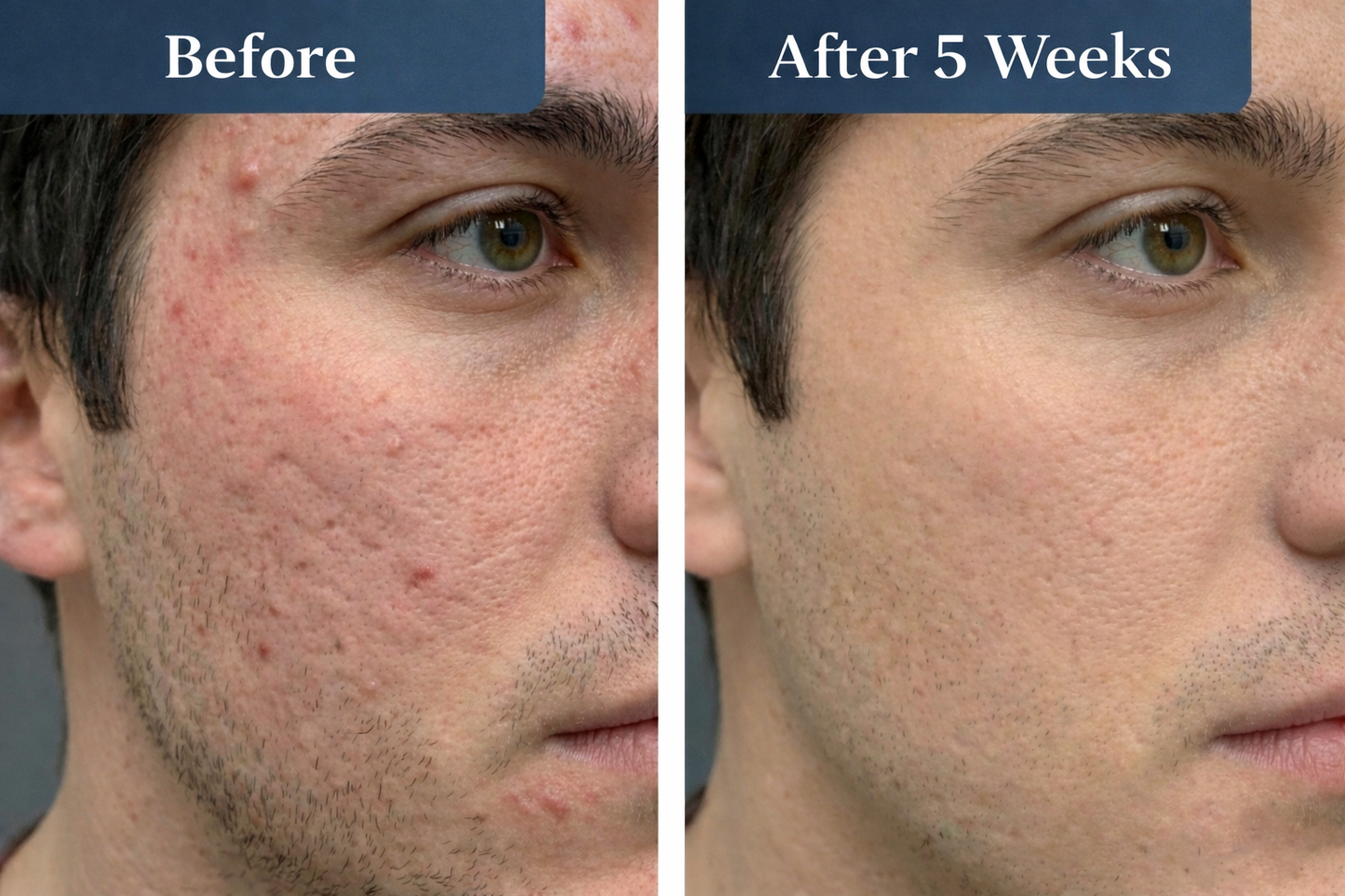 (GHK-Cu) Bioactive Copper Peptides Facial Repair Serum