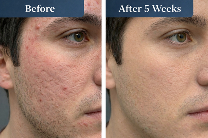 (GHK-Cu) Bioactive Copper Peptides Facial Repair Serum